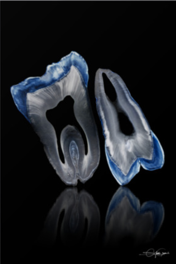 Corte Transversal Dental